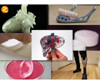 Impresión 3D otra forma de salvar vidas